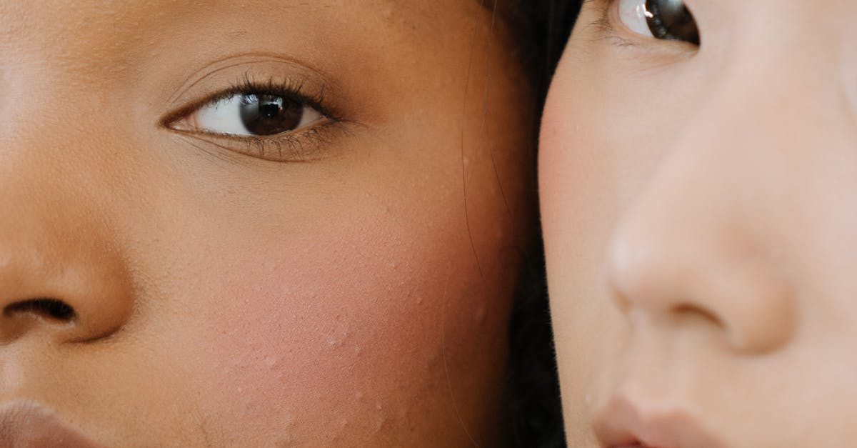 How to Care for Your Skin Following Laser Procedures