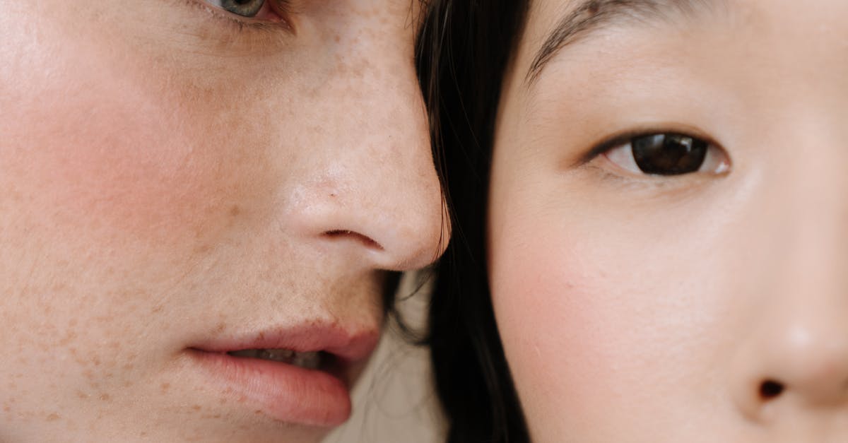 Minimizing Sun Damage with Advanced Laser Solutions